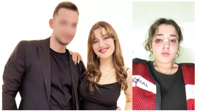 Makiyaj etdiyi üçün döyüldü — Şikayətə baxılmadı