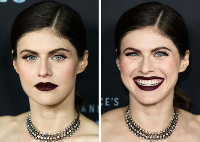 Təbəssüm etdikdə sanki başqa insana çevrilən 17 ULDUZ - FOTO