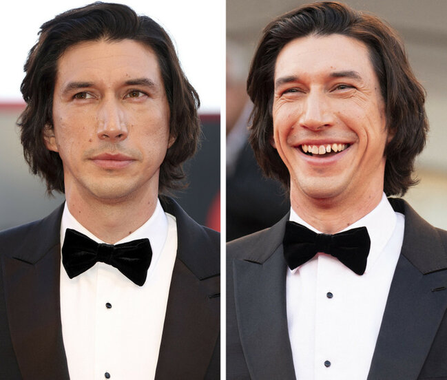 Təbəssüm etdikdə sanki başqa insana çevrilən 17 ULDUZ - FOTO