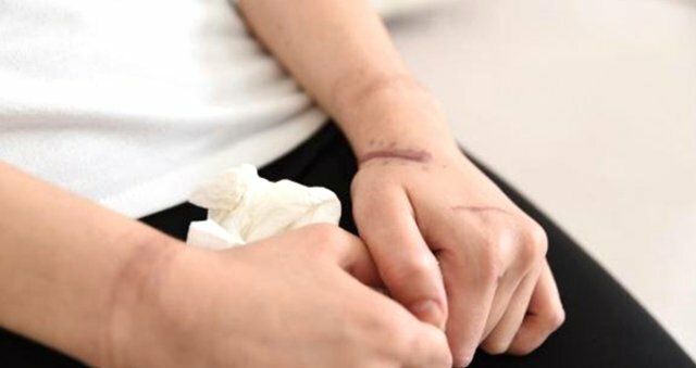 Sevgilisi 25 yaşlı qızın boğazını kəsdi, bıçaqladı və... - Ağlasığmaz işgəncə - FOTOLAR