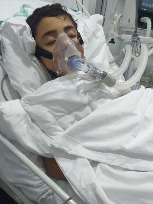 7 yaşlı Vaqifin yardımınıza ehtiyacı var - FOTO