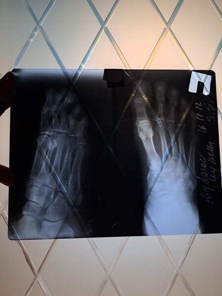 "İnternational Medical Center" TİBB Mərkəzinin həkimi xəstənin ayağını sındıracağı ilə hədələdi - VİDEO - FOTO