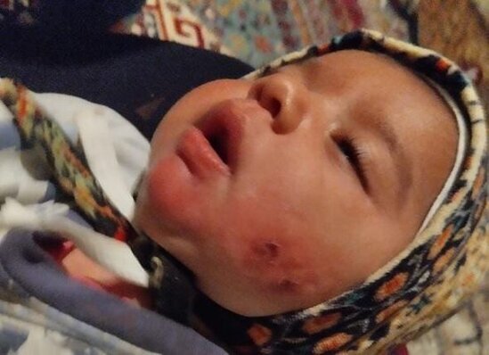 8 aylıq körpə odun sobasının üzərinə düşüb - FOTO