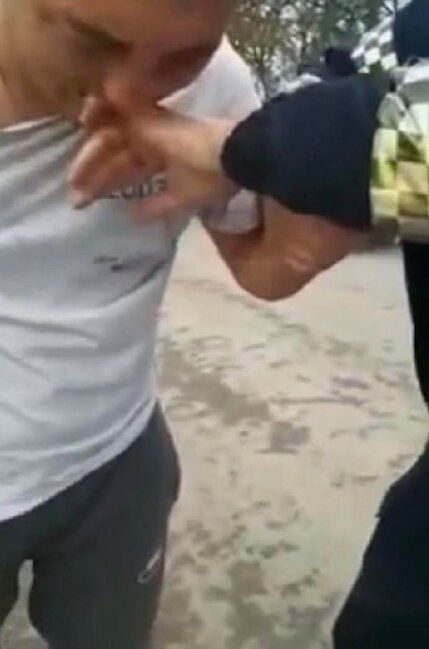 Sərxoş sürücü polisin barmağını 9 dəqiqə dişlədi - FOTOLAR