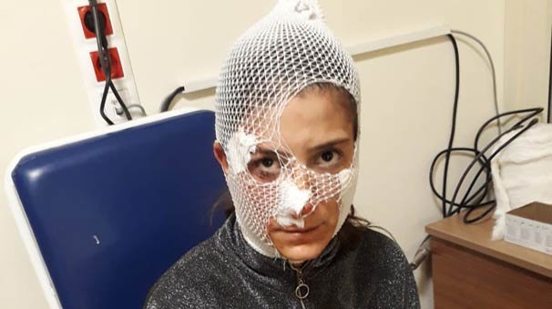 Sevgilisi tərəfindən bıçaqlanan qadın qorxunc hala düşdü - Dəhşətli FOTOLAR