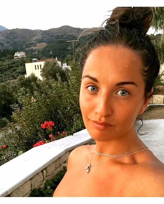 Üzündə ləkələr yaranan 29 yaşlı qadın həkimə getdi, eşitdiklərindən şoka düşdü - FOTOLAR