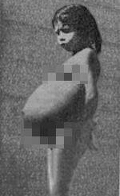 Təcavüzə məruz qalan 5 yaşlı uşaq hamilə qaldı - ŞOK FOTOLAR ÜZƏ ÇIXDI