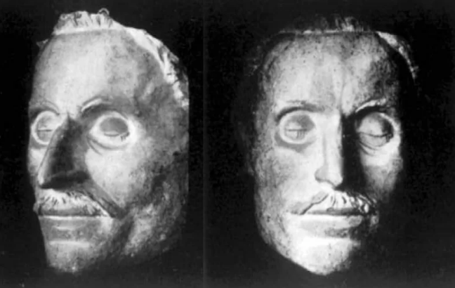 "Hippokrat maskası" – Ölüm yaxınlaşarkən insanın üzü BELƏ OLUR