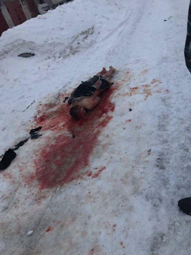 D&Eacute;hÅ&Eacute;tli HADÄ°SÆ: KÃ¼Ã§&Eacute; itl&Eacute;ri 25 yaÅlÄ± g&Eacute;nci parÃ§alayÄ±b Ã¶ldÃ¼rdÃ¼ - FOTO