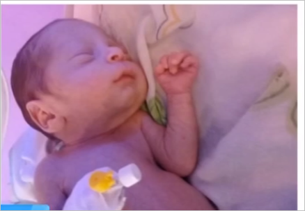 Azərbaycanda 3 aylıq körpənin barmaqları həkim səhvinə qurban getdi - FOTOLAR