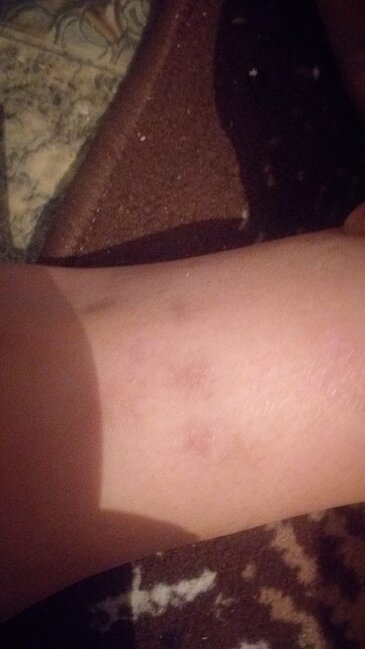 "Qonşu 10 yaşlı uşağı vəhşicəsinə döyüb" - Video