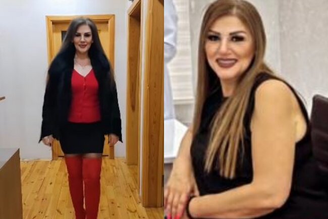 Bu yolla 39 kiloqram arıqlayıb - Fotolar