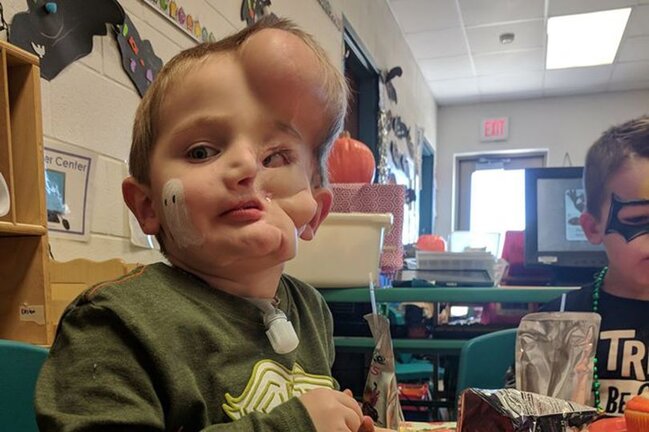 İt uşağı qapıb BU HALA saldı - Uşaqlar 