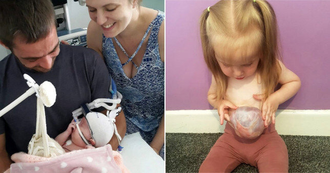 Bu qızın bağırsaqları anadangəlmə bayırdadır - FOTOLAR