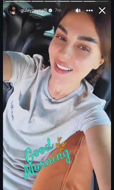Bu da Gülay Zeynallının MAKİYAJSIZ HALI - FOTOLAR
