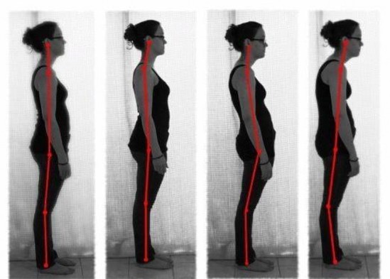 Düz qamət üçün sadə üsul - FOTO