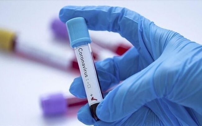 Dünya bu metoddan danışır: Koronavirusa yoluxanların 90%-i sağaldı