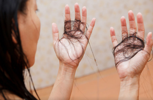 Saç tökülməsinin əsas səbəbləri AÇIQLANDI