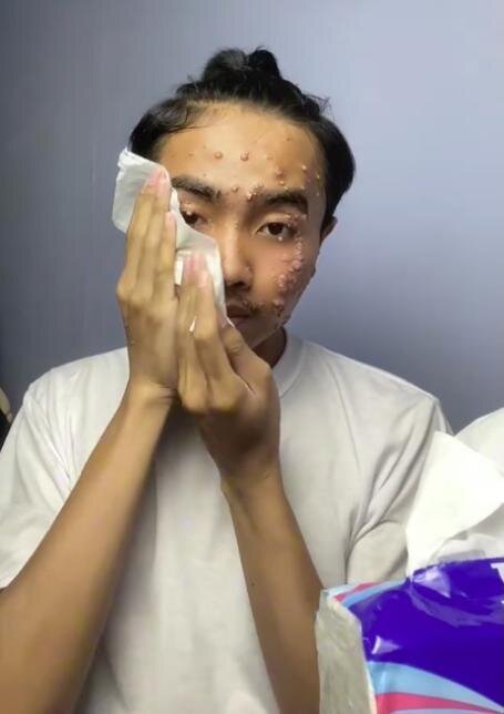 İkinci əl paltar aldı, dərisi bu günə düşdü - FOTO