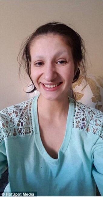 Gözəlləşmək istəyərkən qaşlarını itirdi - FOTOLAR