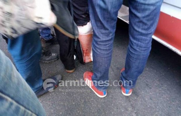 Yerevanda çaxnaşma: Polis deputatı döyərək xəstəxanalıq etdi - FOTO