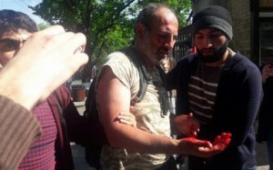 Yerevanda çaxnaşma: Polis deputatı döyərək xəstəxanalıq etdi - FOTO