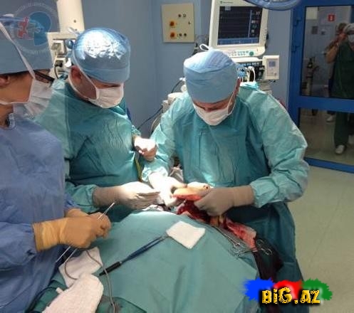26 yaşlı qız yeni sifətə sahib oldu - FOTO