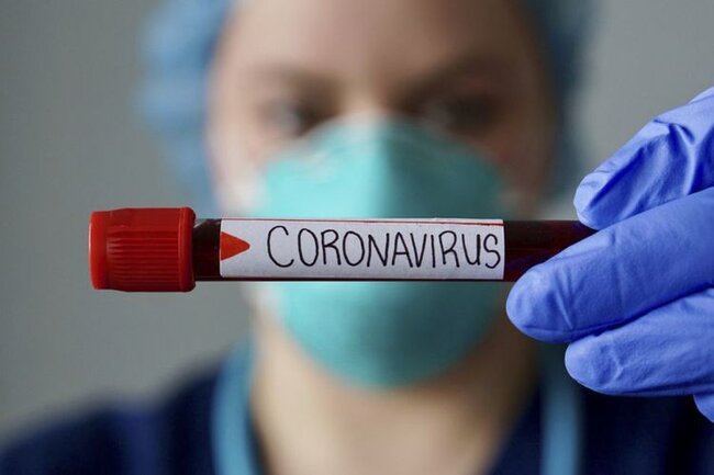 Ermənistanda 2 381 nəfər koronavirusa yoluxdu, 41 nəfər öldü