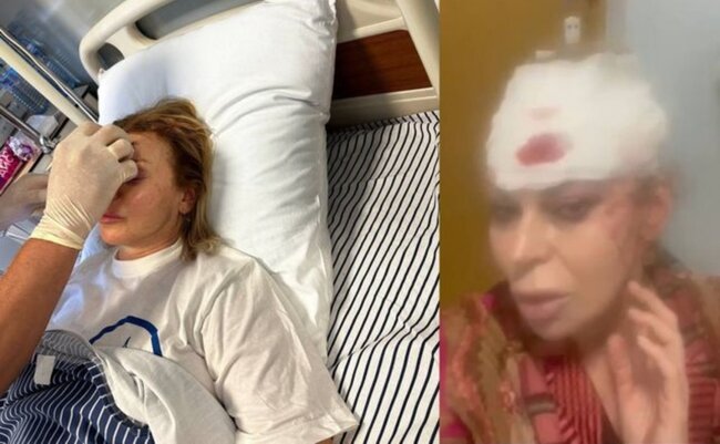 Qəzaya düşən müğənninin son halı - Foto