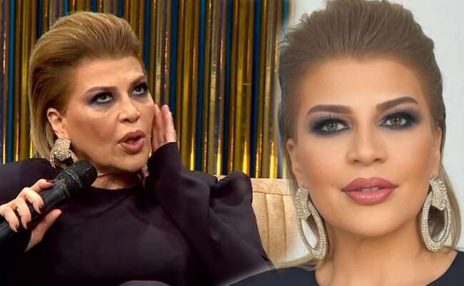 Bu dəfə üzündə plastik əməliyyat etdirəcək