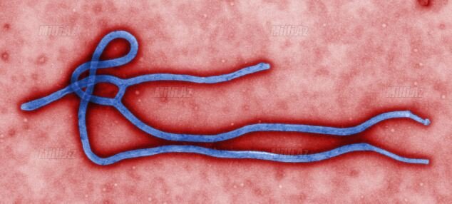 Beynəlxalq xəbərdarlıq: Ebola təhlükəsi böyüyür