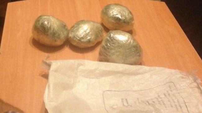 İran vətəndaşının düz bağırsağından çıxanlar hər kəsi təəccübləndirdi - FOTO