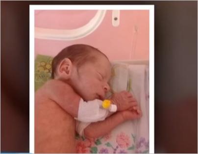 Azərbaycanda 3 aylıq körpənin barmaqları həkim səhvinə qurban getdi - FOTOLAR