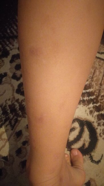 "Qonşu 10 yaşlı uşağı vəhşicəsinə döyüb" - Video