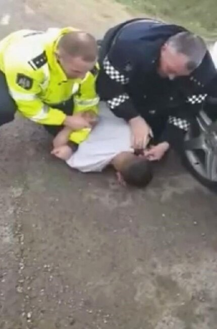 Sərxoş sürücü polisin barmağını 9 dəqiqə dişlədi - FOTOLAR