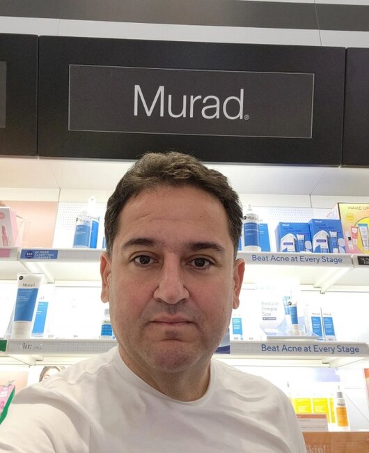 İzləyiciləri Murad Dadaşovu tanımadılar - FOTO