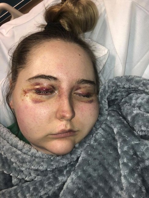 Tətildən qayıdan qız dəhşətli xəstəliyə tutuldu - FOTOLAR