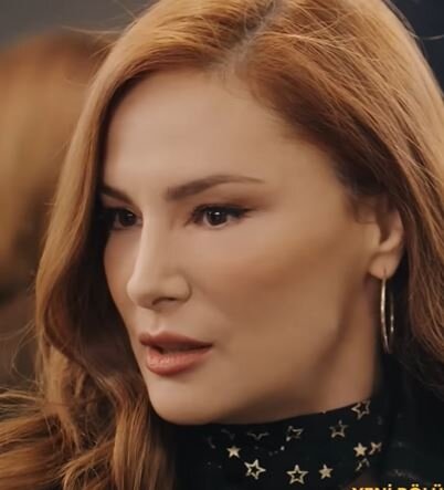 "Yalı çapkını"nın yeni aktrisasının estetiki müzakirə yaratdı - FOTO