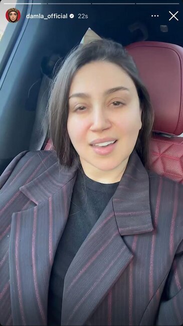 Damlanın makiyajsız görüntüsü təəccübləndirdi - Foto