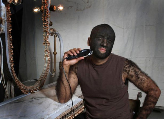 Dünyanın ən tüklü insanı - Hamı ondan danışır - FOTOLAR