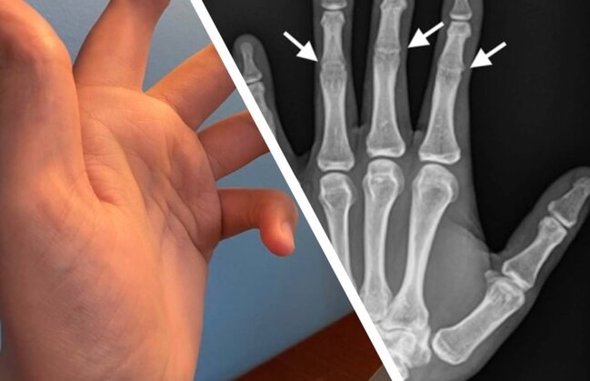 Bu adamın əlində orta oynaqlar YOXDUR - FOTO