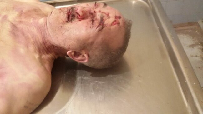 Maşınla vurulub öldürülən piyadanın yaxınları axtarılır - FOTO