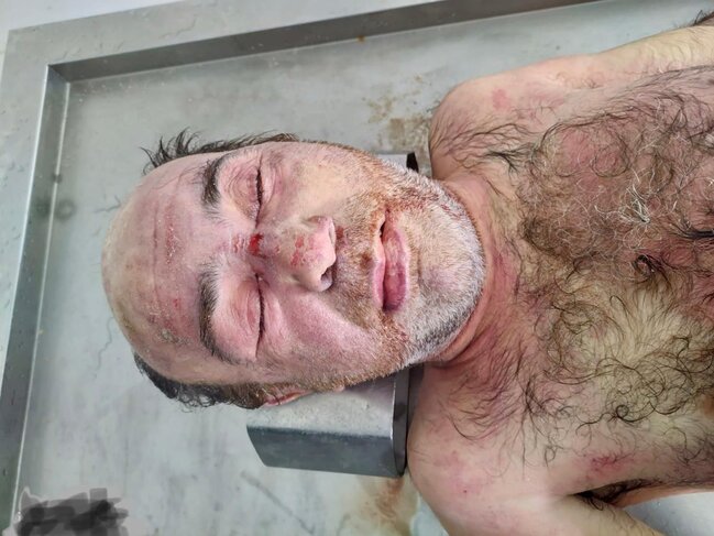 Bakıda binanın həyətindən meyit tapıldı - FOTO +18