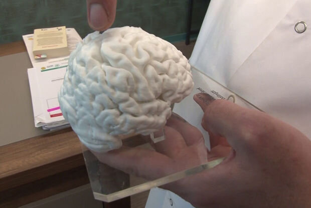 Türkiyədə İLK: 3D printerlə insan beyninin nüsxəsi hazırlandı - VİDEO