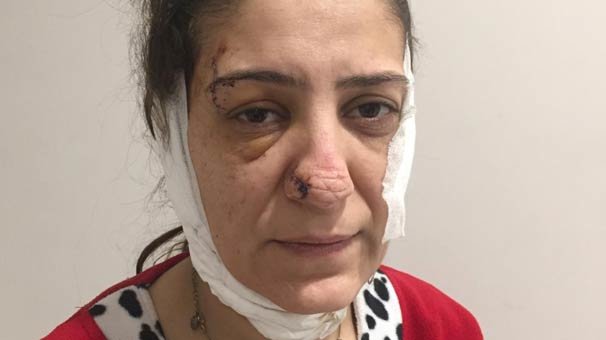 Sevgilisi tərəfindən bıçaqlanan qadın qorxunc hala düşdü - Dəhşətli FOTOLAR