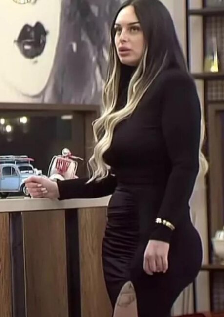 Uğursuz estetik əməliyyatı edən Yaren OD PÜSKÜRDÜ - FOTO