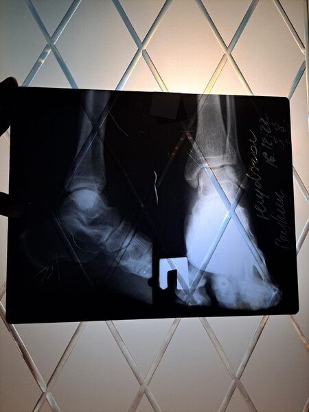 "İnternational Medical Center" TİBB Mərkəzinin həkimi xəstənin ayağını sındıracağı ilə hədələdi - VİDEO - FOTO