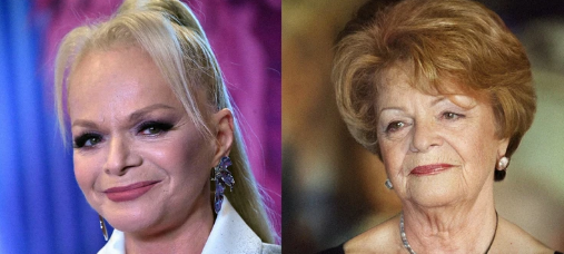 Estetika olmasaydı, məşhurlar necə görünərdi?