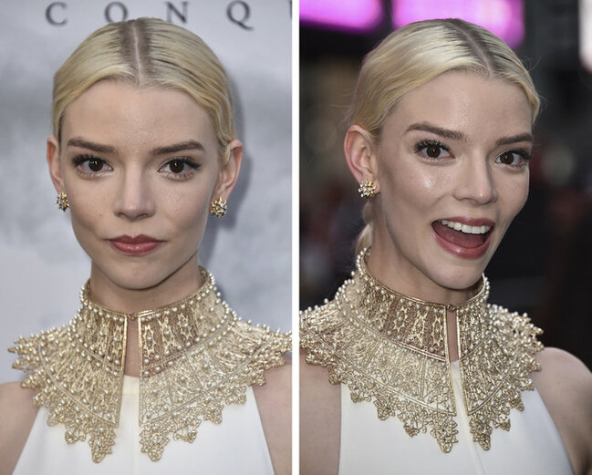 Təbəssüm etdikdə sanki başqa insana çevrilən 17 ULDUZ - FOTO