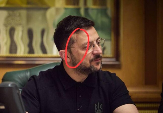 Zelenskinin üzü ilə bağlı İDDİALAR: XƏSTƏLİK, DAVA... - FOTO